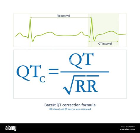 bazzet|QT interval